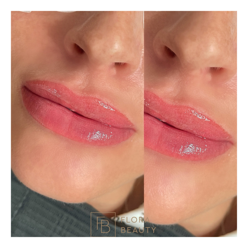 Natürlich volle Lippen – perfekte Lippenform – klare Lippenkontur