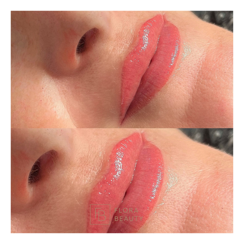 Natürlich volle Lippen – perfekte Lippenform – klare Lippenkontur